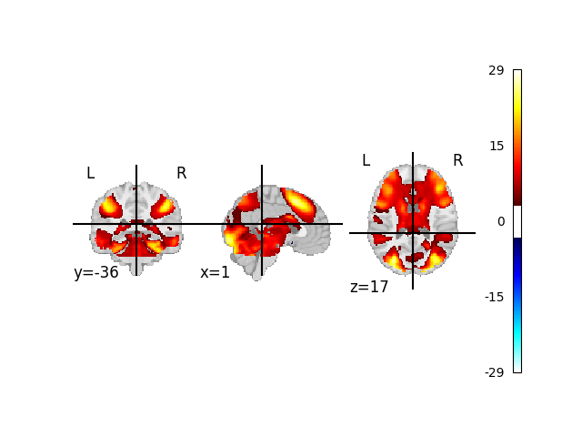 03 plot neurovault io